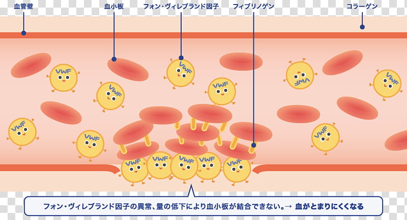 Patient, Von Willebrand Disease, Von Willebrand Factor, Haemophilia, Text, Blood, Cartoon, Nose transparent background PNG clipart