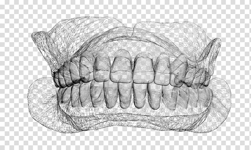Mouth, Overdentures, Veneer, Dental Implant, Dental Technician, Dental Laboratory, Finger, Dentistry transparent background PNG clipart