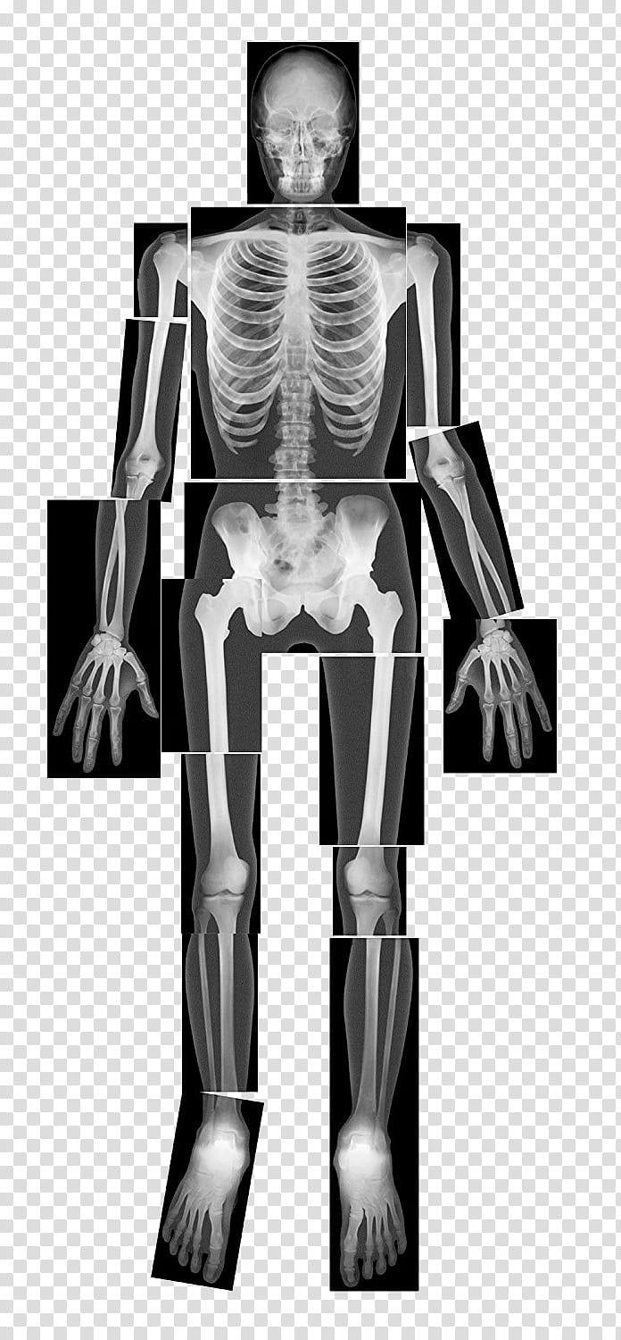 x ray clip art black and white