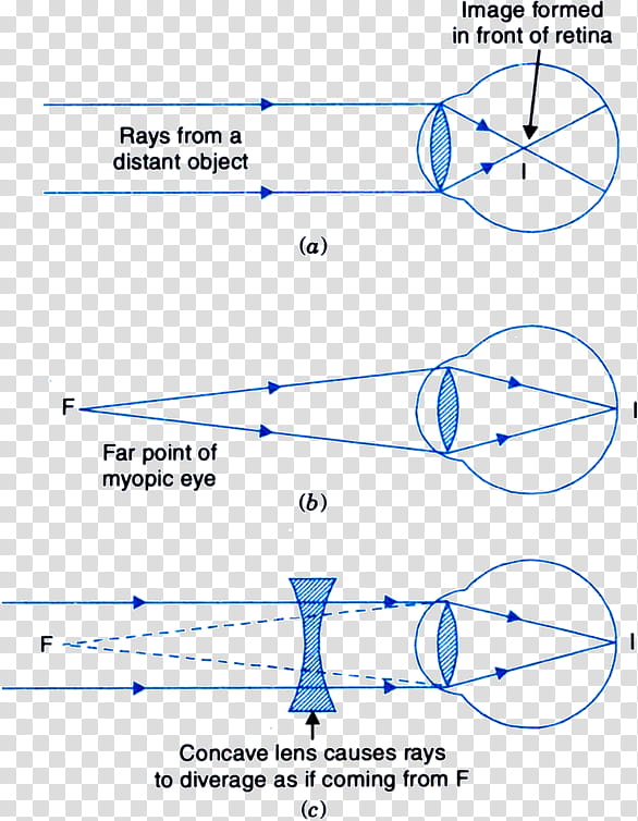 Circle Pattern, Nearsightedness, Eye, Lens, Farsightedness, Cornea, Diagram, Visual Perception transparent background PNG clipart