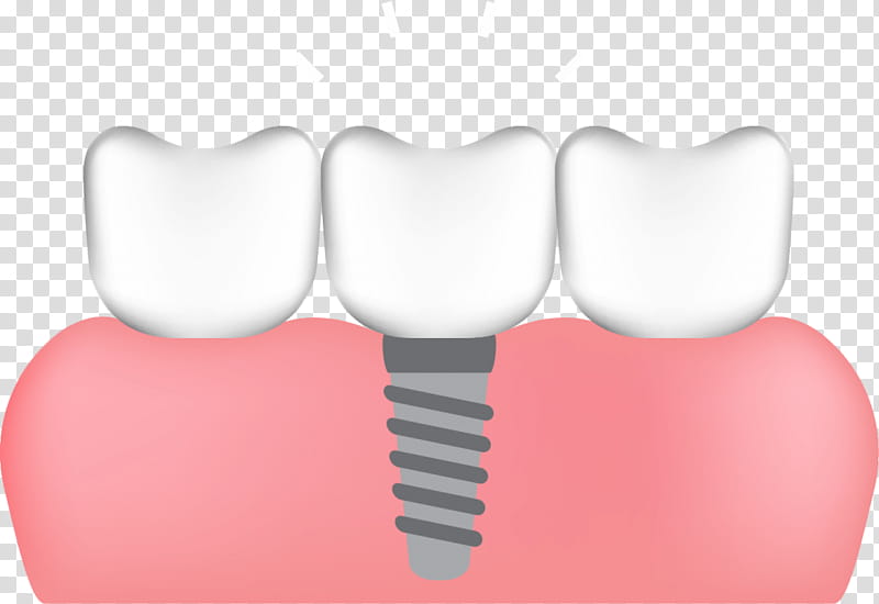 Human Heart, Tooth, Dental Implant, Human Tooth, Allon4, Dentistry, Sinus Lift, Bone Grafting transparent background PNG clipart