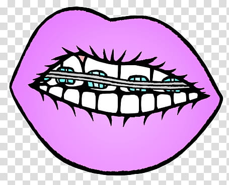 lips with purple lipstick with braces on teeth transparent background PNG clipart