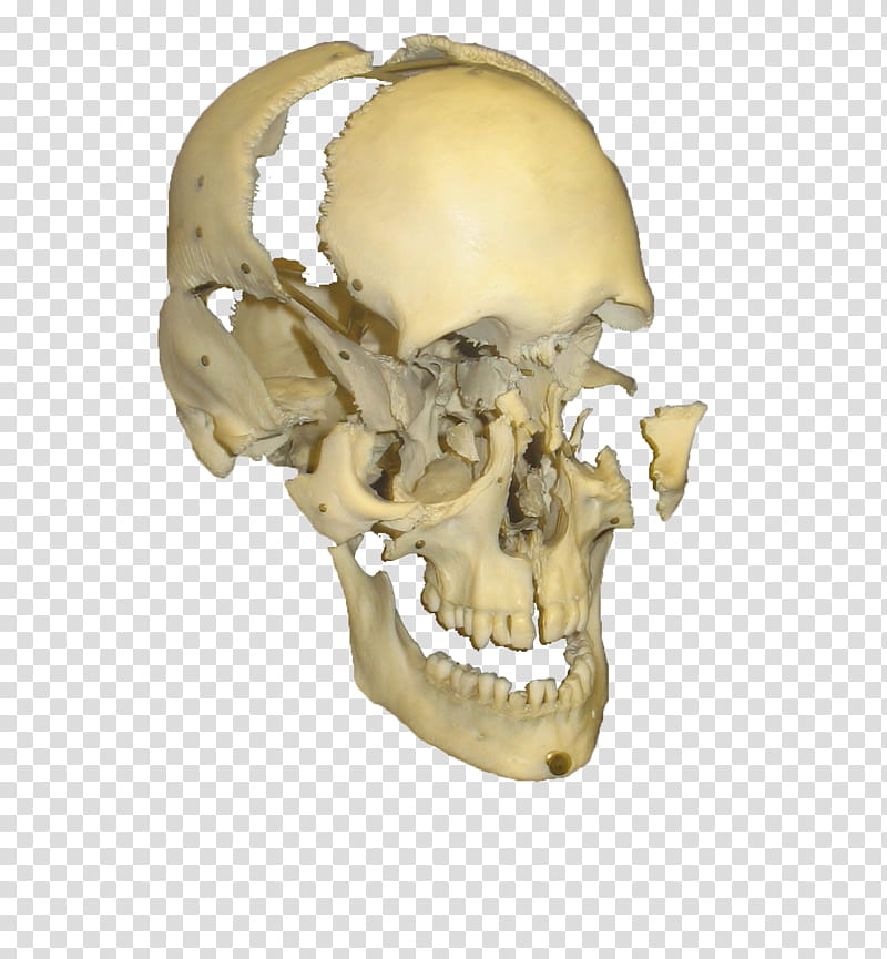 Exploded Human Skull, human skull illustration transparent background PNG clipart