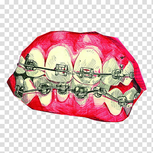 teeth braces transparent background PNG clipart