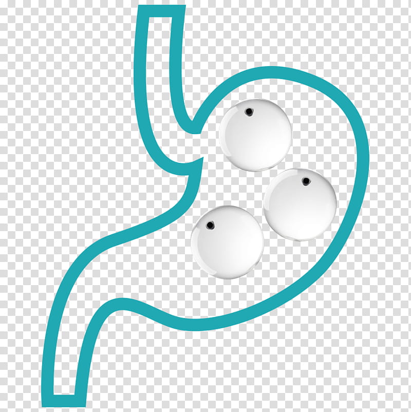 Balloon, Gastric Balloon, Weight Loss, Surgery, Bariatric Surgery, Patient, Health, Bariatrics transparent background PNG clipart